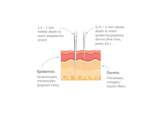 SkinPen microneedling procedure chart